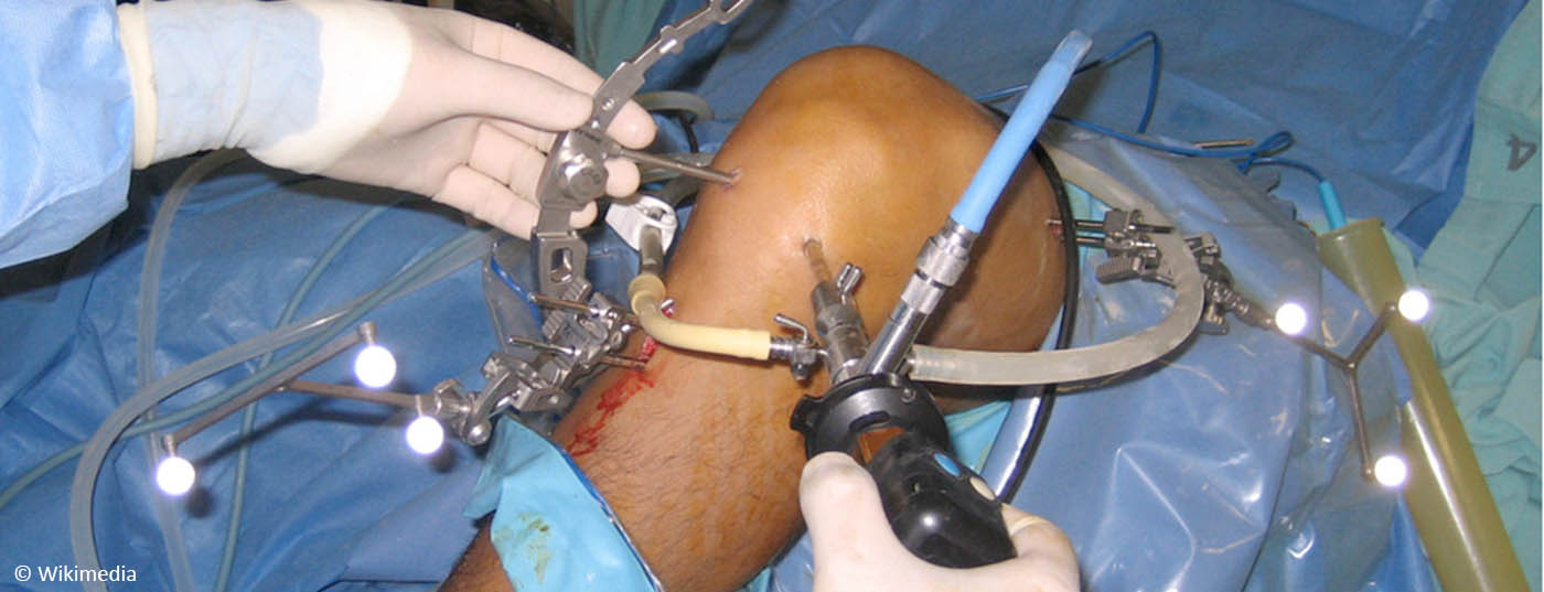 arthroskopische_knieoperation