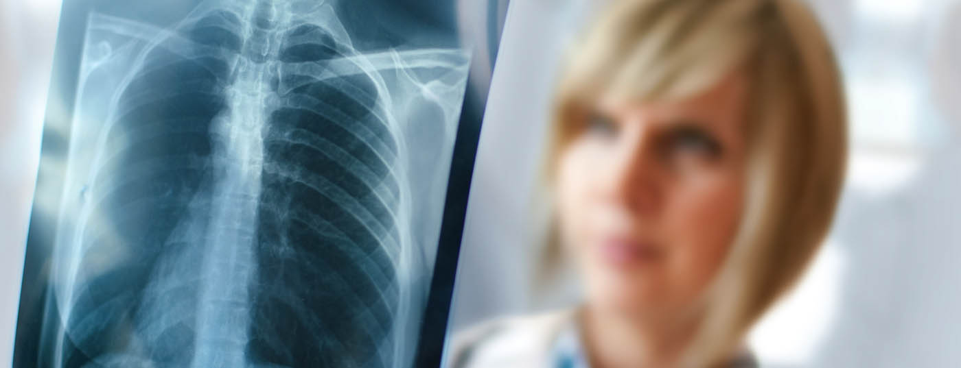 lunge_roentgen