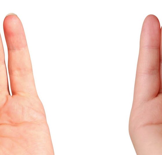 ohr_hoeren_sprechen_orl