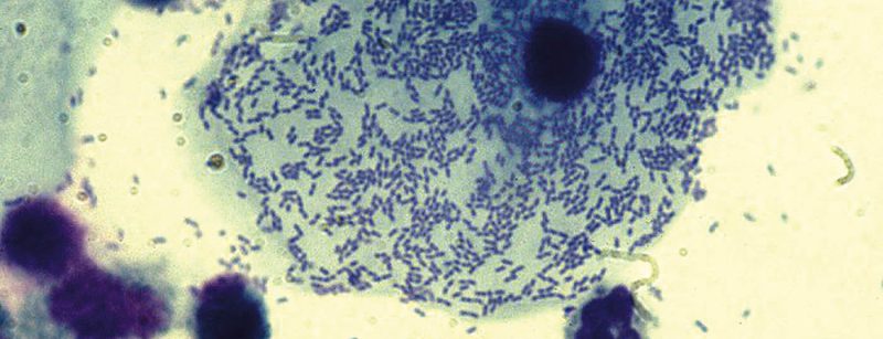 gardnerellen_gynaekologie