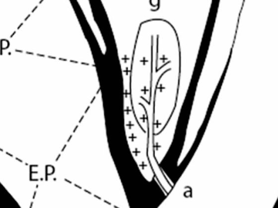 head_karotissimulation