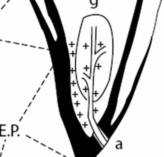 head_karotissimulation