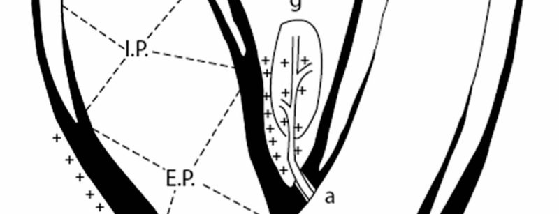 head_karotissimulation