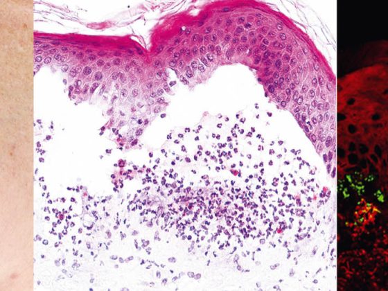 header_cme-editorial_dp4