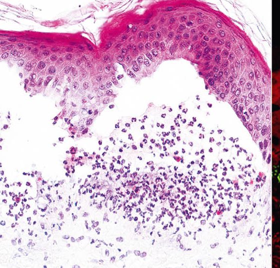 header_cme-editorial_dp4
