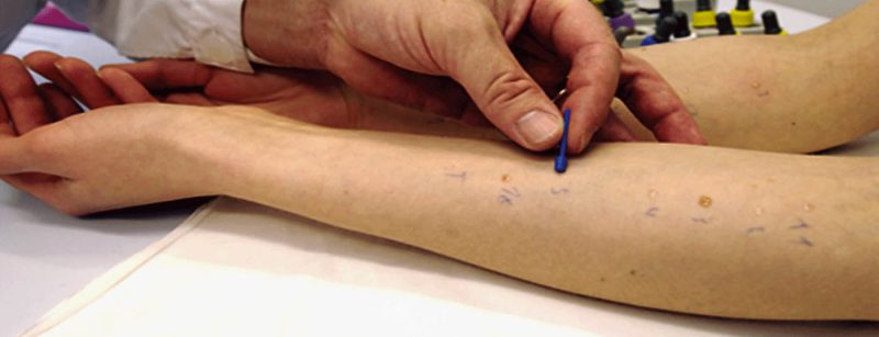 prick_allergie_test
