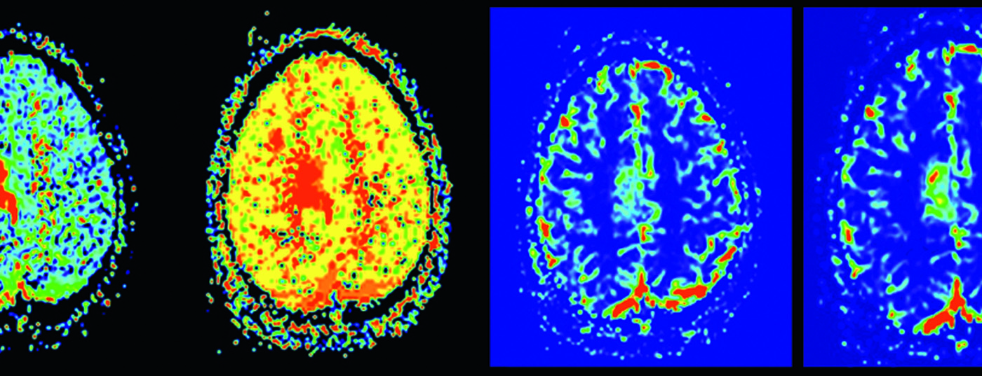 header_neuroimages_np1-15