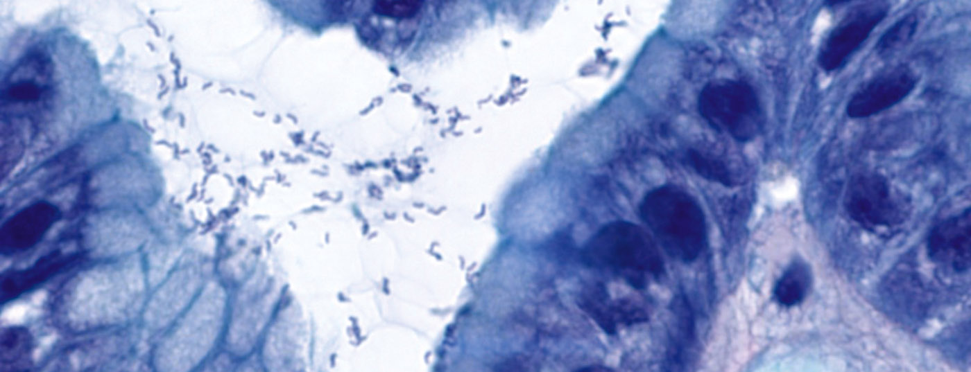 helicobacter2