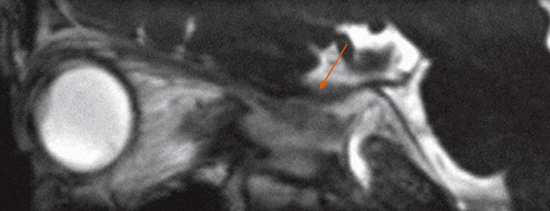 header_neuroimages