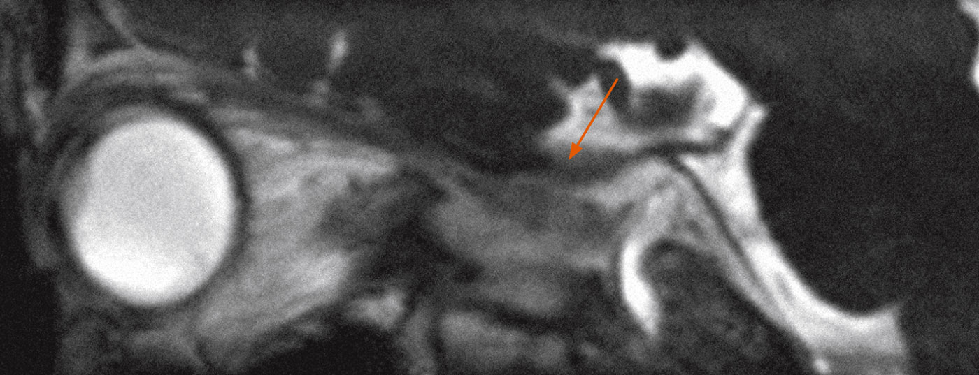header_neuroimages