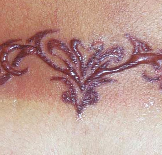 allergie_tattoo_blackhenna