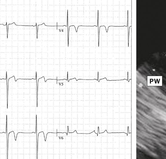 header_cv2_kardialerisiken