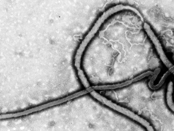 ebola