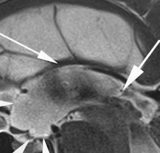 header_neuroimages_np3