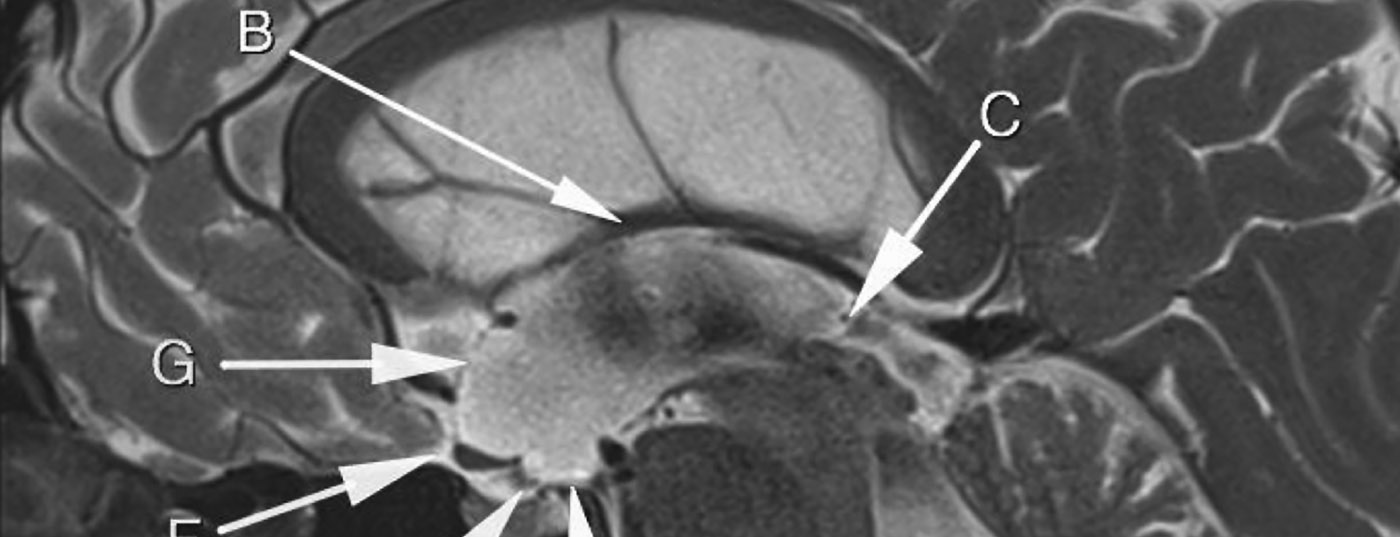 header_neuroimages_np3