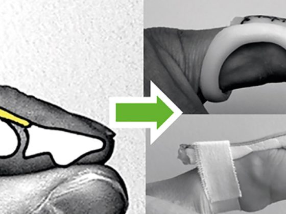 header_hp8_fingerruptur