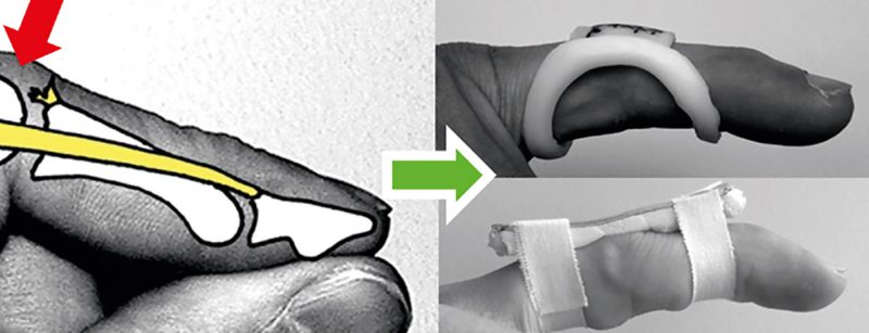 header_hp8_fingerruptur