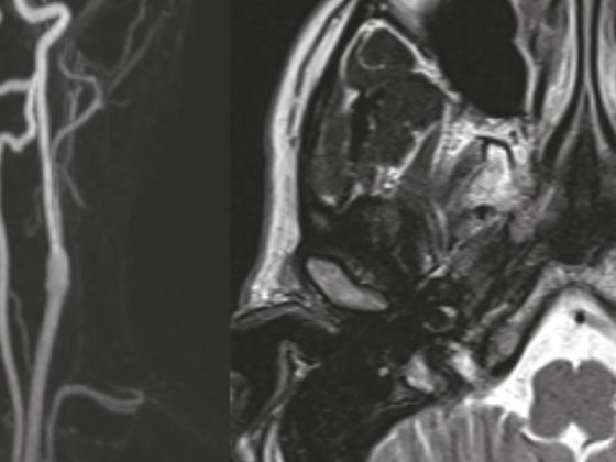 header_neuroimages_np5-15