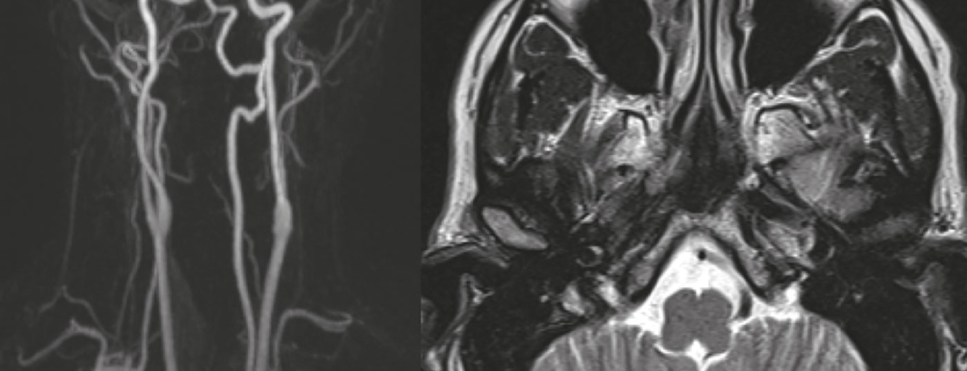 header_neuroimages_np5-15