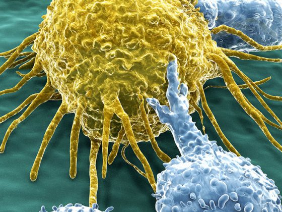 t-zelle_lymphozyten_krebs