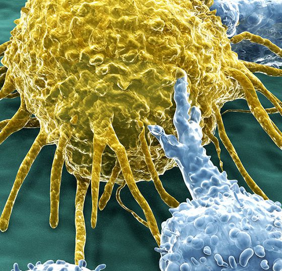 t-zelle_lymphozyten_krebs