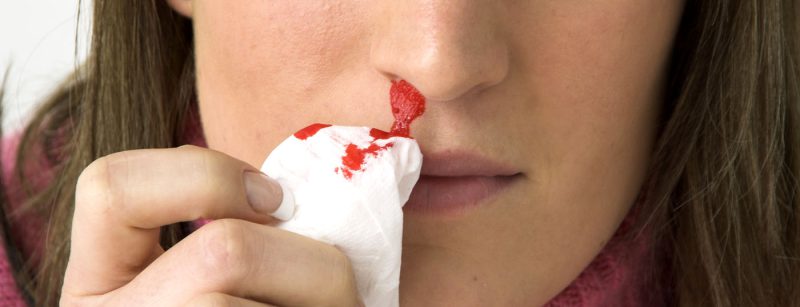 nasenbluten_head