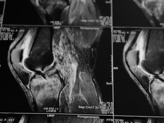 ct_head