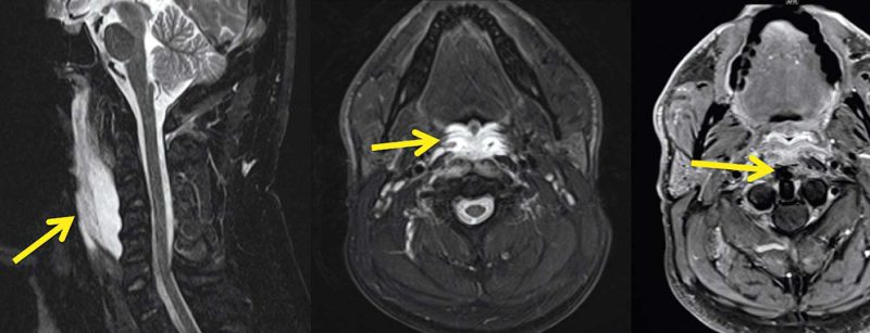 neuroimages_np1