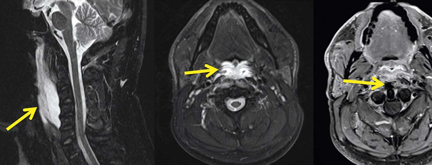 neuroimages_np1