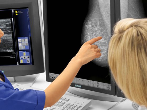 brustkrebs