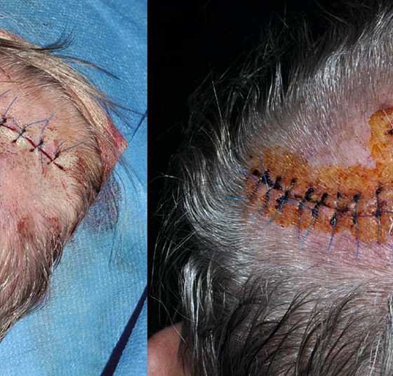 header_dermatochirurgie