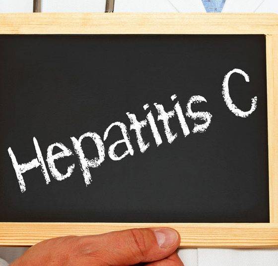 hepatitis-c