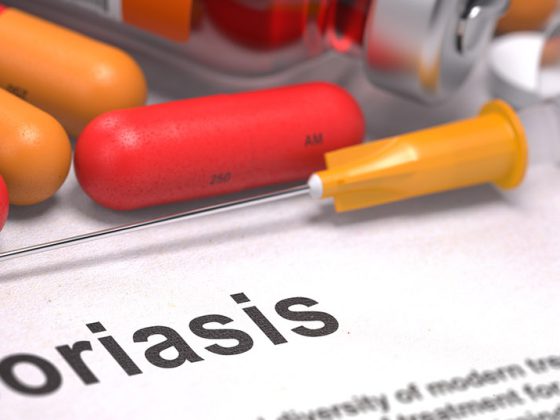 psoriasis_schuppenflechte2