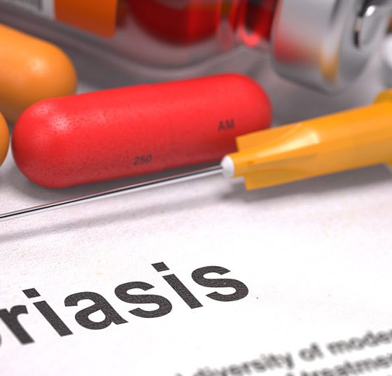 psoriasis_schuppenflechte2