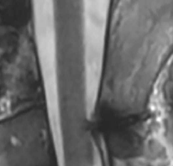 header_neuroimages_np3