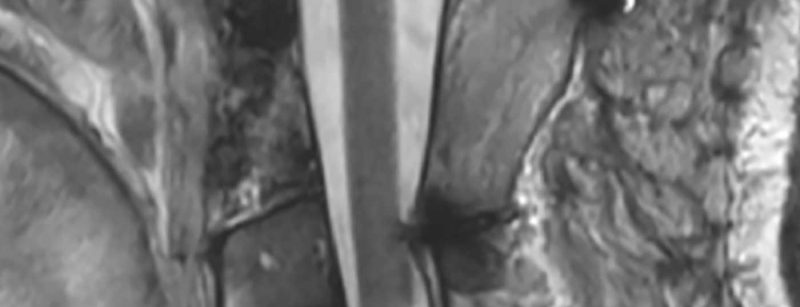 header_neuroimages_np3