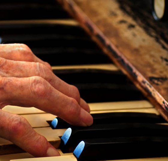 rheuma_arthritis_hand