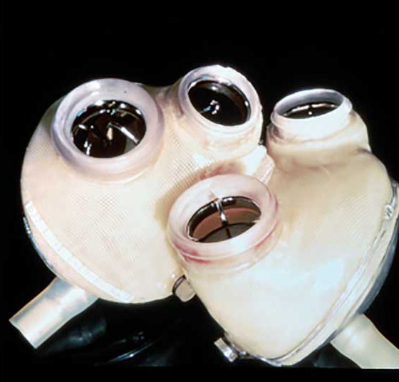 schrittmacher_header