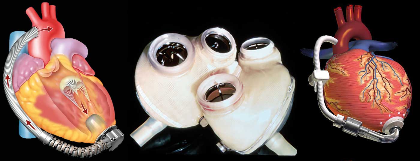 schrittmacher_header