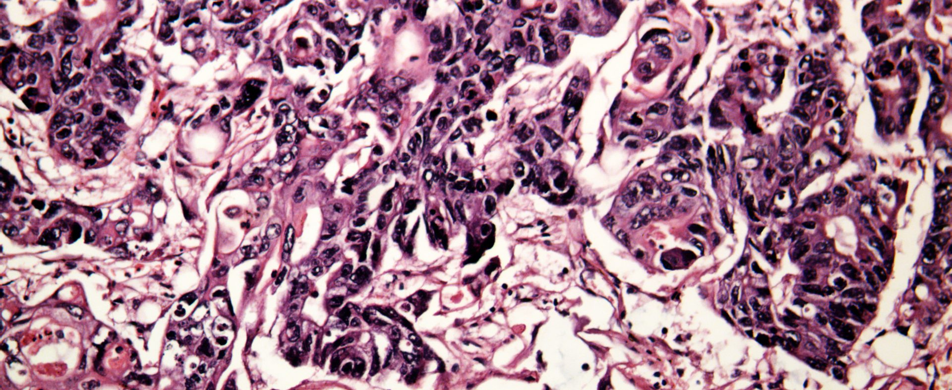 dreamstime_xxl_29670811