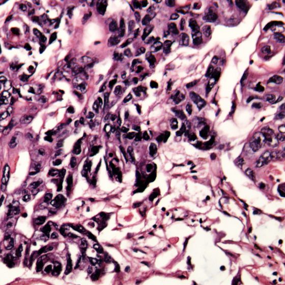 dreamstime_xxl_29670811