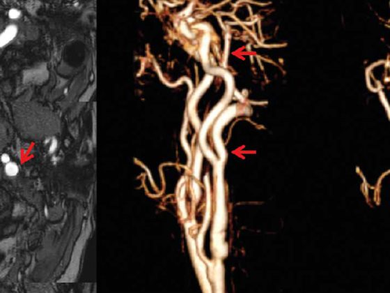 header_neuroimages_np5