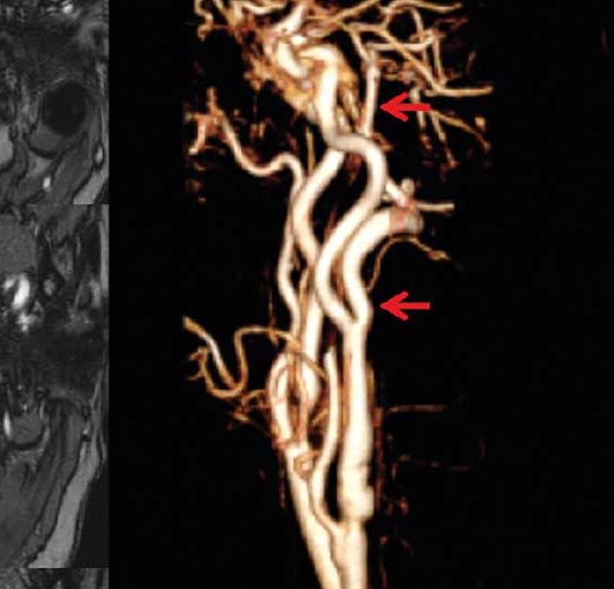header_neuroimages_np5
