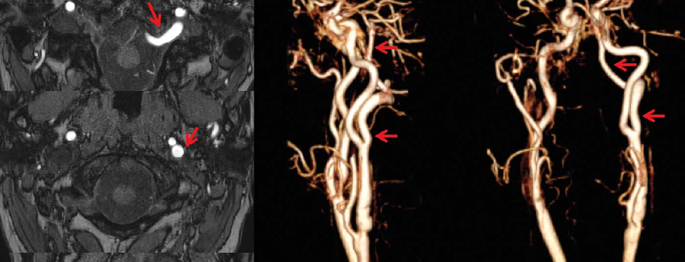 header_neuroimages_np5