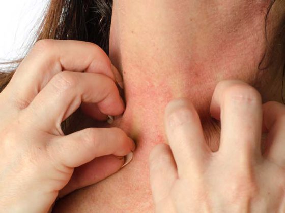 haut_juckreiz_dermatitis