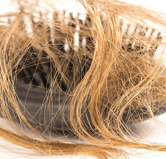 haarausfall_116489512_m