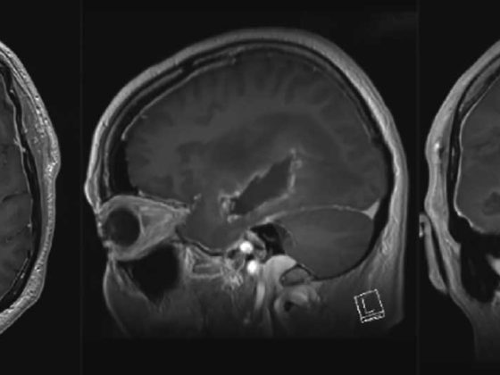 header_neuroimages_np1