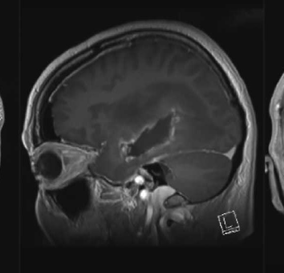 header_neuroimages_np1