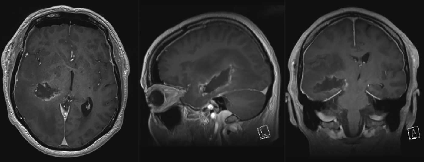 header_neuroimages_np1