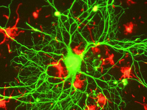 neuron_in_tissue_culture